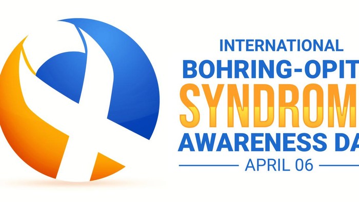 6 April Hari Sindrom Bohring-Opitz, Begini Sejarah dan Penjelasannya