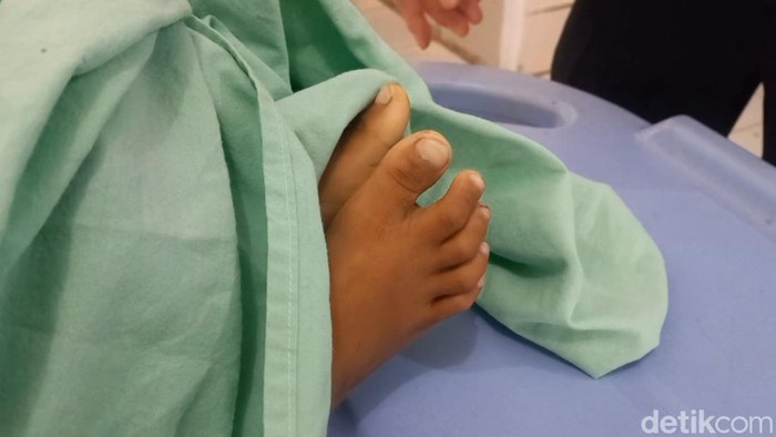 Jasad bocah empat tahun yang tewas di dalam angkot di Purwakarta.