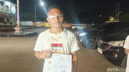 Hemax Rihi Herewila seusai membuat laporan polisi di Mapolresta Kupang Kota, Kamis (4/4/2024) malam. (Yufengki Bria/detikBali).