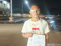Viral Ketua Bemnus NTT Dipukuli Polisi Saat Demo, Kapolresta Membantah