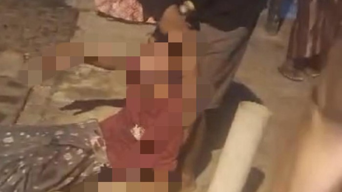 Remaja Gresik terluka karena main mercon saat tarawih.