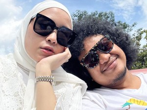 Istri Babe Cabita Bicara soal Lelang Vespa hingga Luka