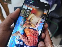 Remaja di Palembang Dibacok Tetangga hingga Tangannya Nyaris Putus