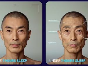 Foto Mencengangkan Wajah yang Tidak Tidur 7 Jam Sehari vs Cukup Tidur