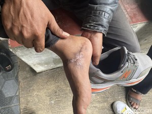 Pilu Buruh di Sukabumi: Kaki Patah, Dipaksa Resign, Upah Tak Dibayar