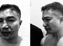 Saling Lapor Oknum Polisi-Nakes Gorontalo Usai Cekcok Perkara Wanita