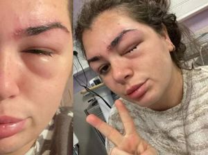 Viral Wanita Sulam Alis Berujung Fatal, Mata Kiri Tak Bisa Melihat hingga Terancam Buta