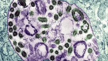 Pada tahun 1980, seorang insinyur Prancis dari pabrik gula terdekat tertular virus Marburg yang membuat tubuhnya meleleh saat mengunjungi Gua Kitum. Foto: via Daily Mail