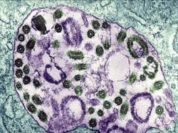 Melongok Gua di Kenya yang Penuh Virus Mematikan