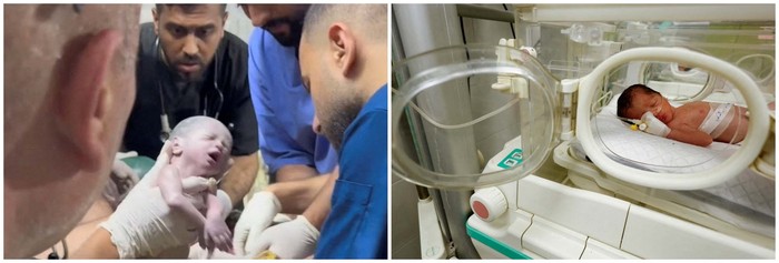 A combination picture shows a Palestinian newborn girl who was pulled alive from the womb of her mother Sabreen Al-Sheikh (Al-Sakani), after she was killed in an Israeli strike, along with her husband Shokri and her daughter Malak, amid the ongoing conflict between Israel and the Palestinian Islamist group Hamas, as she is handled by medics after being taken out of the womb, on April 20, 2024 (left), and as she lies in an incubator on April 21, 2024 (right), in Rafah, in the southern Gaza Strip. Reuters TV via REUTERS and REUTERS/Mohammed Salem
