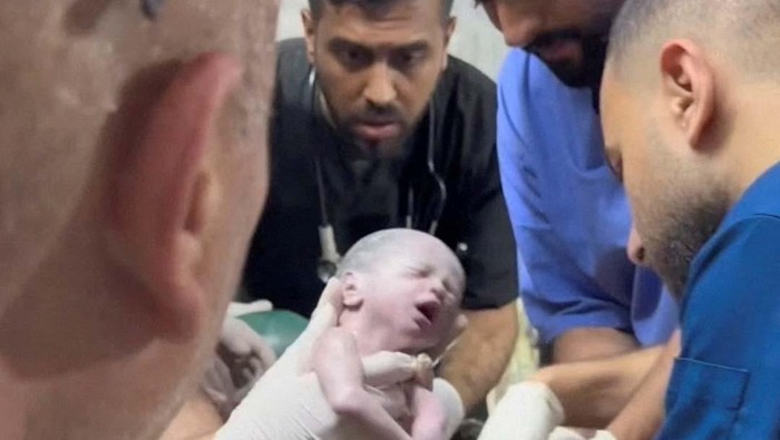 A combination picture shows a Palestinian newborn girl who was pulled alive from the womb of her mother Sabreen Al-Sheikh (Al-Sakani), after she was killed in an Israeli strike, along with her husband Shokri and her daughter Malak, amid the ongoing conflict between Israel and the Palestinian Islamist group Hamas, as she is handled by medics after being taken out of the womb, on April 20, 2024 (left), and as she lies in an incubator on April 21, 2024 (right), in Rafah, in the southern Gaza Strip. Reuters TV via REUTERS and REUTERS/Mohammed Salem