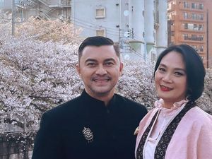 Dian Nitami Oplas di Usia 53 Tahun, Anjasmara Beri Dukungan Penuh