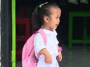 Cerita Anak Kurir yang Hidup dengan Penyakit Langka dan Tubuh Tak Sempurna