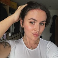 Setelah melepas jahitan, dahi Beth pun terlihat jauh lebih kecil. Perubahan pada penampilan membuatnya merasa seperti orang yang baru. Foto: Instagram/@hxlsey