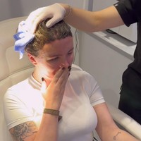 Beth sadar bahwa operasi plastik bisa menjadi solusi mengatasi rasa minder dan tidak aman yang telah lama dia derita. Beth menjalani operasi pengecilan dahi pada awal Maret 2024. Prosedur ini sebenarnya bukan mengurangi ukuran kepala maupun dahi, melainkan menurunkan garis rambut agar dahi tampak lebih kecil.Foto: Instagram/@hxlsey