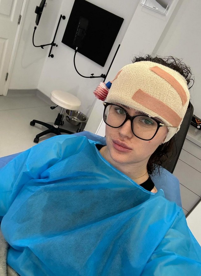 Saat kecil dan remaja, Beth kerap diejek ‘berkepala lima’ oleh teman-temannya karena ukuran dahi yang tidak biasa itu. Ejekan itu menimbulkan luka mendalam pada harga dirinya, meninggalkan bekas yang sulit hilang hingga memasuki usia dewasa. Foto: Instagram/@hxlsey