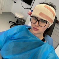 Saat kecil dan remaja, Beth kerap diejek ‘berkepala lima’ oleh teman-temannya karena ukuran dahi yang tidak biasa itu. Ejekan itu menimbulkan luka mendalam pada harga dirinya, meninggalkan bekas yang sulit hilang hingga memasuki usia dewasa. Foto: Instagram/@hxlsey