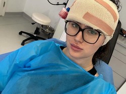 Diolok-olok Manusia Berkepala Lima, Wanita Ini Operasi Pengecilan Dahi