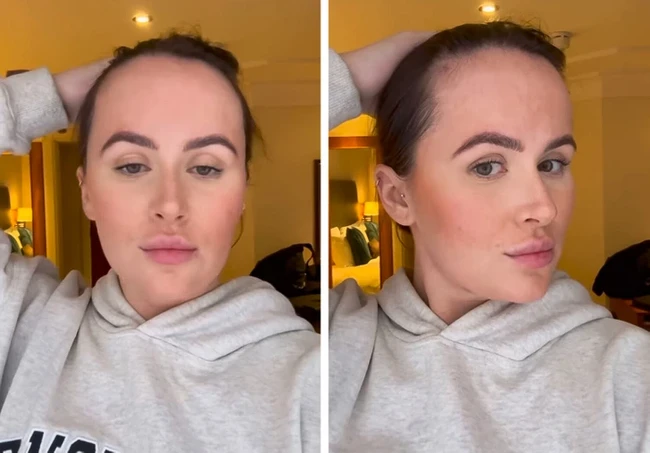 Beth Halsey sering jadi korban bully karena dahinya yang lebar, hingga membuatnya tidak percaya diri. Foto: Instagram/@hxlsey