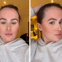 Beth Halsey sering jadi korban bully karena dahinya yang lebar, hingga membuatnya tidak percaya diri. Foto: Instagram/@hxlsey