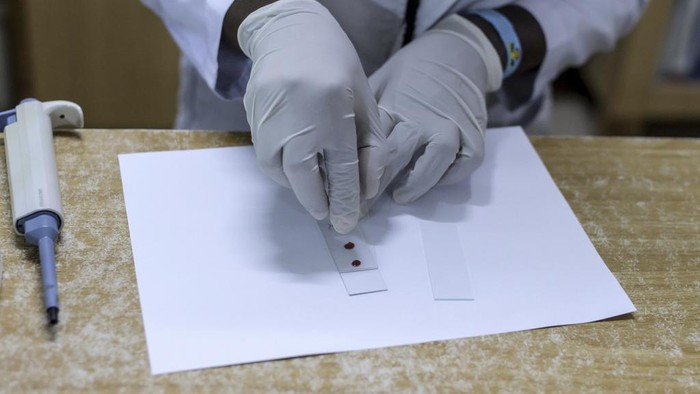 Friends and family prepare to lower the casket of Rose Bella Awuor, 31 years, after a funeral service at her home in Awendo, Migori County, Kenya Thursday, April. 11, 2024. Awuor fell ill in December and lost her five-month pregnancy before succumbing to malaria. It was the latest of five deaths in this family attributed to malaria. The disease is endemic to Kenya and is preventable and curable, but poverty makes it deadly for those who can't afford treatment. (AP Photo/Brian Ongoro)