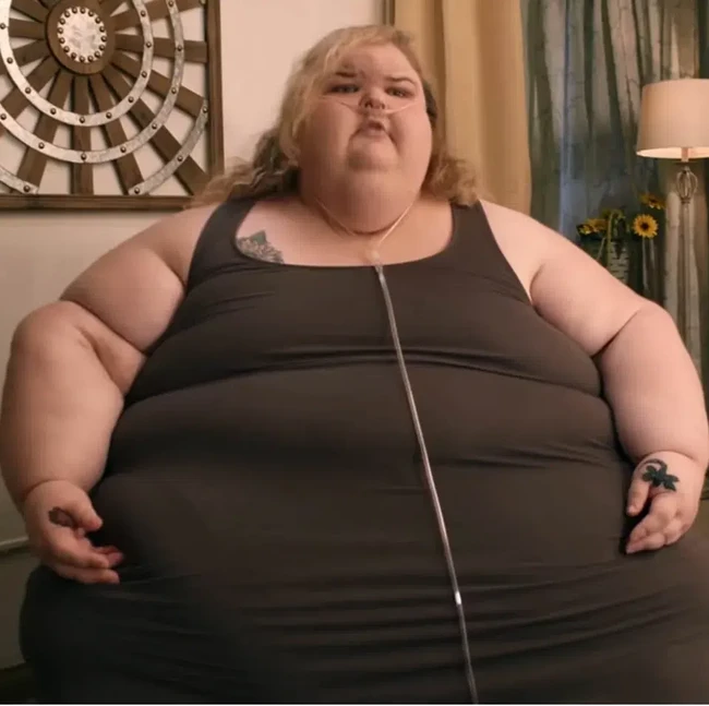 Foto: Before Vs After Wanita Sukses Pangkas BB hingga 225 Kg, Auto Pangling!