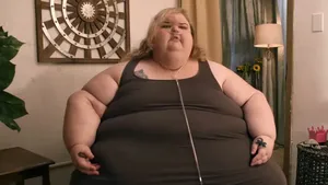 Foto: Before Vs After Wanita Sukses Pangkas BB hingga 225 Kg, Auto Pangling!