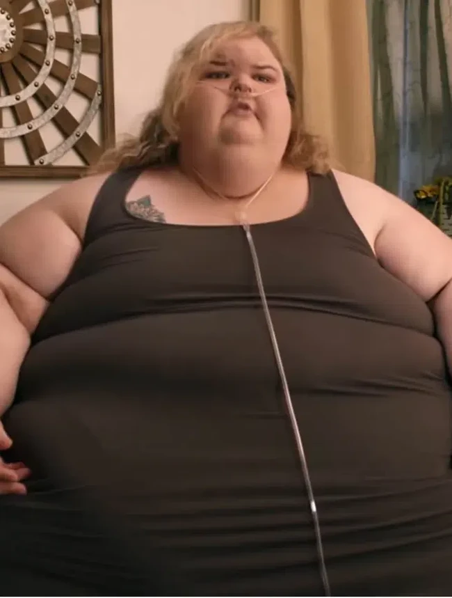 Foto: Before Vs After Wanita Sukses Pangkas BB hingga 225 Kg, Auto Pangling!