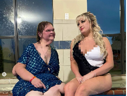 Penampilan Mengejutkan YouTuber Dulu Beratnya 329 Kg, Kini Jadi Begini