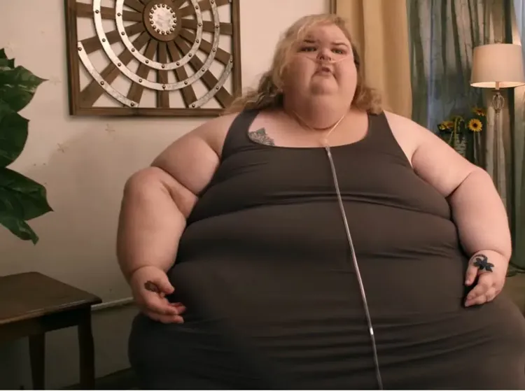 Foto: Before Vs After Wanita Sukses Pangkas BB hingga 225 Kg, Auto Pangling!