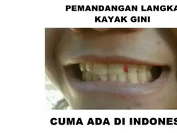 12 Hal yang Cuma Ada di Indonesia, Salah Satunya Kerokan