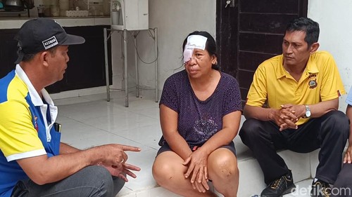 Salah satu warga Jembrana yang digigit anjing.