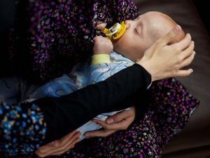 Derita Bayi-bayi di Gaza Tak Kunjung Usai, Kini Terancam kena Meningitis