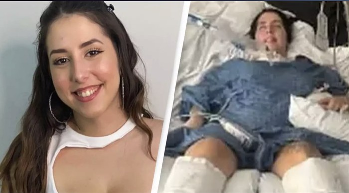 Gegara Makan Sup Kemasan, Wanita ini Sakit Sampai Pakai Ventilator