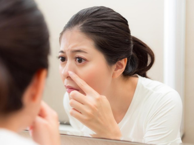 Ilustrasi jerawat hidung