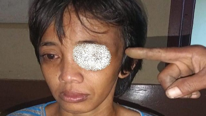 IRT di Lubuklinggau jadi korban KDRT.