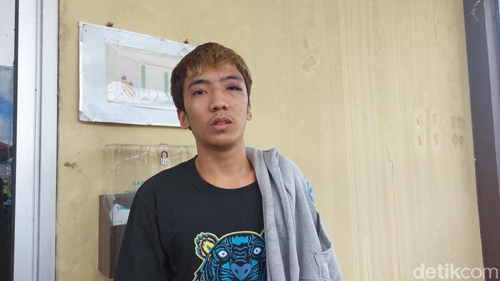 Pemuda Pelambang mengalami luka lebam usai dihajar temannya