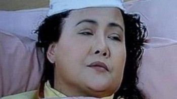 Tinggi banget perbannya. Foto: X/mowtly