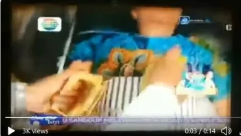 Alat kejut jantung yang dipakai di perut. Aish, bingung aku. Foto: Instagram