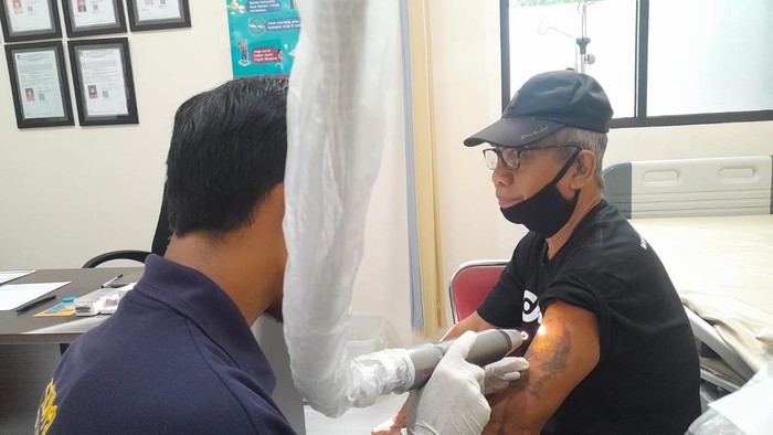 Peserta program hapus tato di Banyuwangi