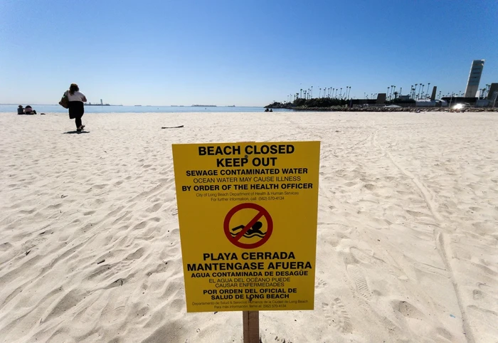 Kotoran manusia di pantai-pantai Inggris