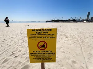 Ternyata Pantai di Inggris Menjijikkan, Karena Buang Berak Sembarangan