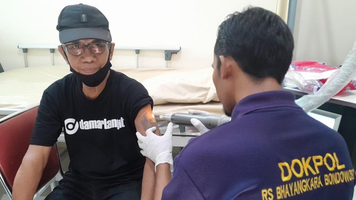 Kakek Willy saat mengikuti program hapus tato gratis di Polresta Banyuwangi.