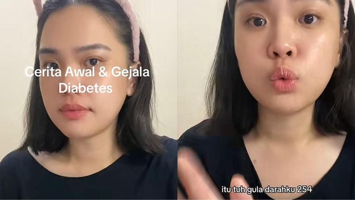 Viral Wanita Kena Diabetes di Umur 32, Gula Darahnya Nanjak di Angka 250