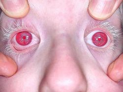 Keunikan Genetik yang Dimiliki Orang-orang di Dunia, Kamu Juga Punya?