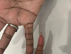 Keunikan Genetik yang Dimiliki Orang-orang di Dunia, Kamu Juga Punya?