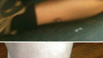 Ada loh orang yang terlahir dengan puting di kakinya. Foto: lrofe24 via Bored Panda