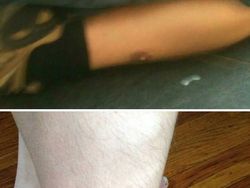 Keunikan Genetik yang Dimiliki Orang-orang di Dunia, Kamu Juga Punya?