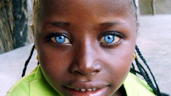 Saya seorang sukarelawan Peace Corps di Afrika Barat. Saya tinggal di desa yang sama dengan gadis bernama Suru ini. Selain matanya yang indah, dia benar-benar tuli dan memiliki bercak kulit putih di tangan kanannya, kata pemilik foto tersebut. Foto: Ayreis via Bored Panda