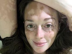 Keunikan Genetik yang Dimiliki Orang-orang di Dunia, Kamu Juga Punya?